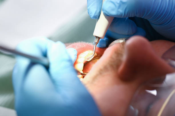 Best Emergency Dental Care for Broken or Chipped Teeth in Dunmore, PA